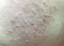 独家：维尼修斯阿森纳夺冠的简单介绍|BG大游真人